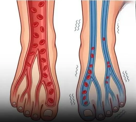 Feel Tired All the Time? It Might Be Your Circulation