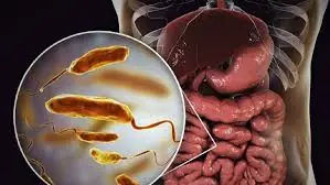 Are Heartburn and Bloating Ruining Your Day? Here’s How to Get Rid of the Bacteria Behind It