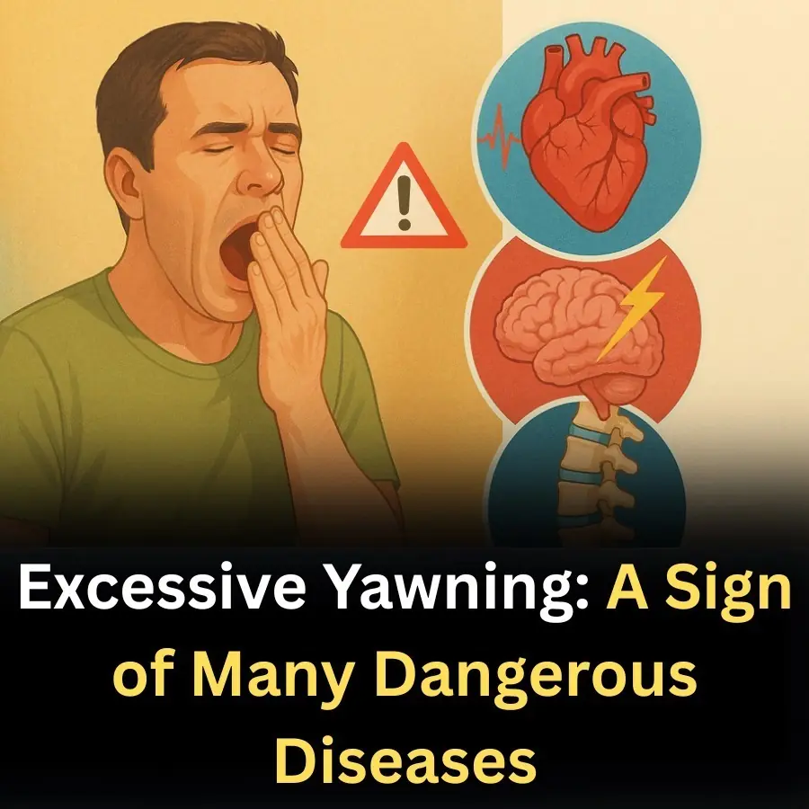 Excessive Yawning: A Sign of Many Dangerous Diseases