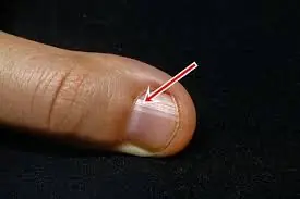 These Nail Lines After 40 Could Be Warning Signs — Here’s What They Mean