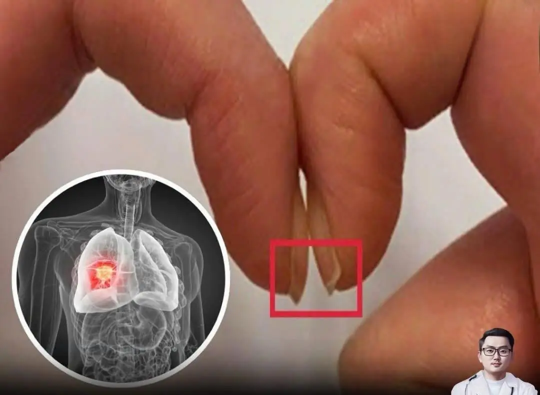 This simple fingernail test could help save your life