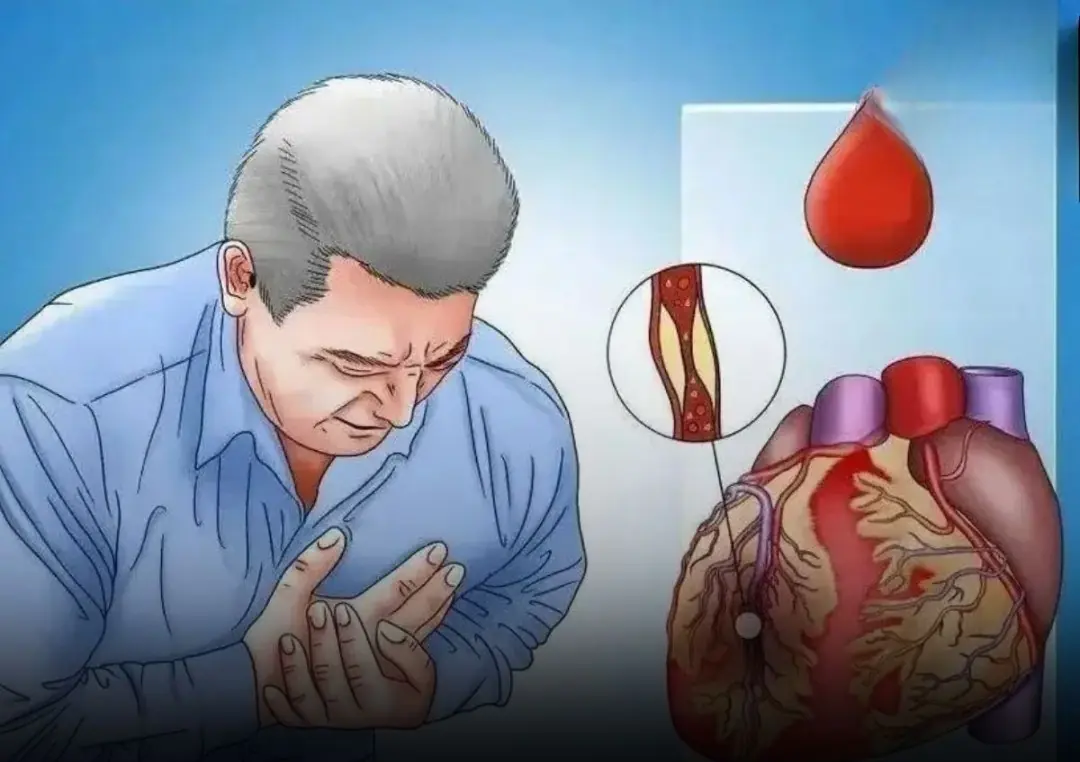 Heart Attacks Don’t Happen Randomly — They Strike at These Exact Moments