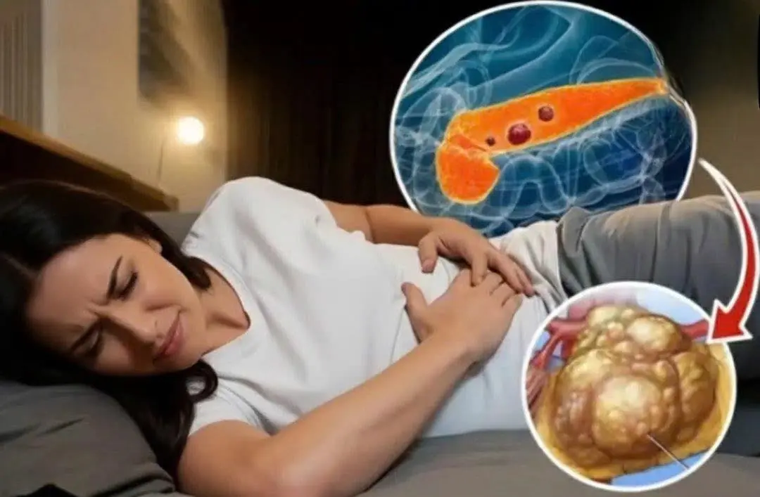 Pan.creatic can.cer: 10 early warning signs you should never ignore