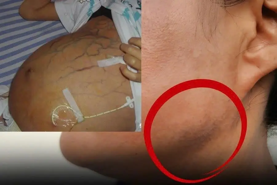 Can:cer may show up as DARK patches… Do you have any of these 7 signs?