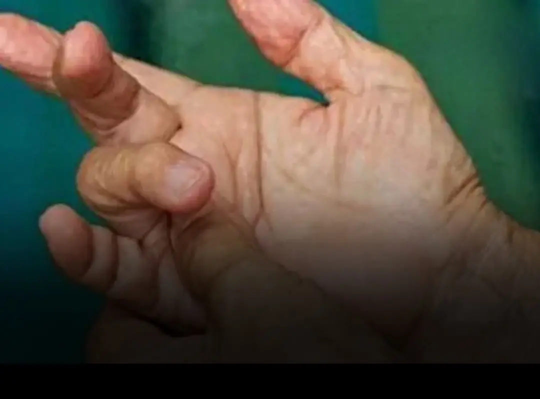 You may find this hard to believe, but in fact, many small changes in the body