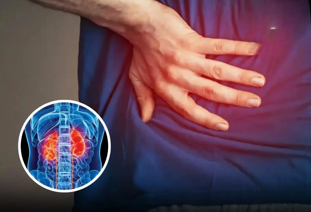 5 Silent Night Symptoms That May Indicate Kidney Dam:age