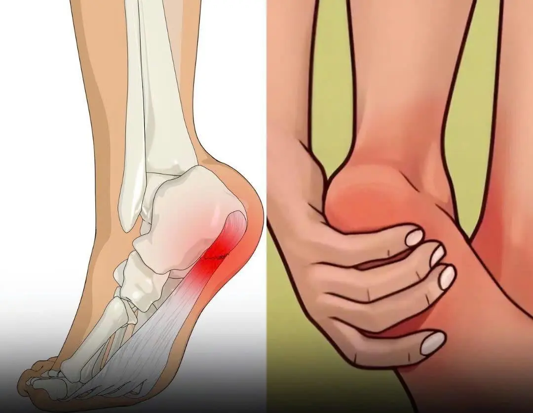 Heel Pain in the Morning? Here’s What Your Body Is Trying to Tell You