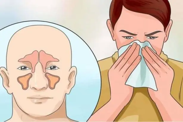 Why You Have Mucus in Your Throat: Common Causes Explained