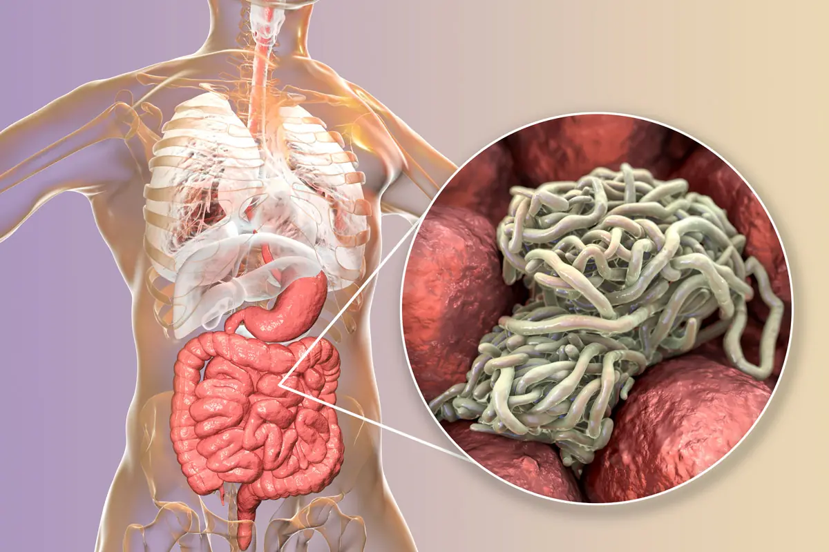 Pinworms in Children: What They Are and Why They Cause Nighttime Itching