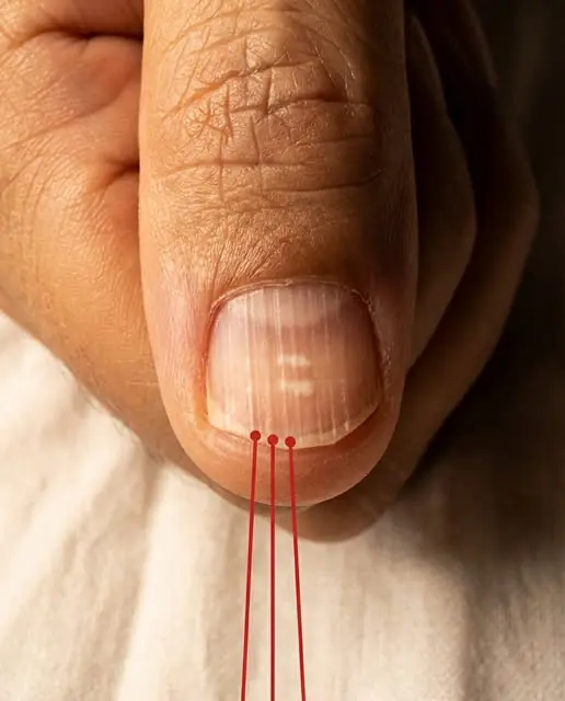 If You Notice These Lines on Your Nails After 40, It Could Be a Warning Sign of Your Health