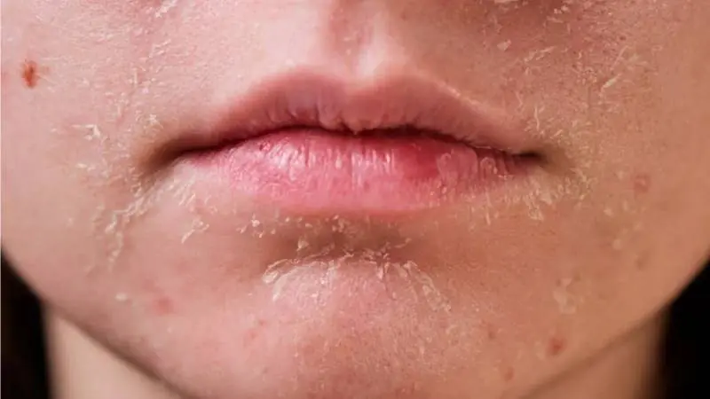 3 Skin Clues Your Kidneys Might Be Unhealthy—No Signs? You’re in the Clear!