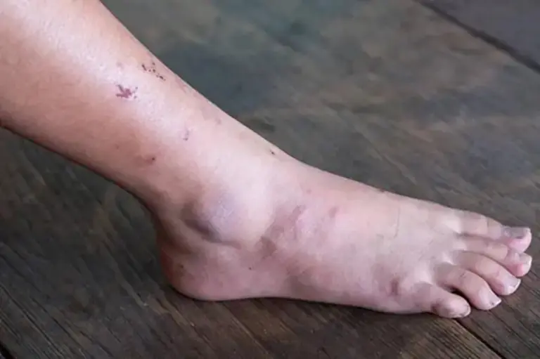 When Can.cer Begins to Form, the Body Often Feels “3 Things Wrong” — But Most People Ignore Them