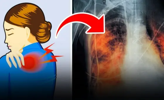 Pain in these 3 spots shouldn’t be ignored — it may signal lung can.cer