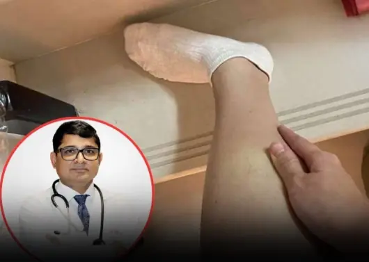 Beware of Diabetes If You Frequently Experience These 5 Strange Symptoms