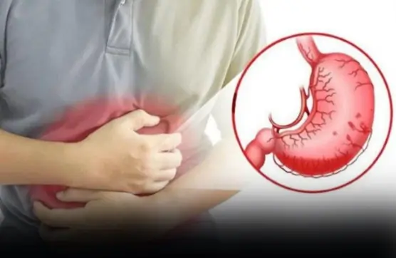 8 wa.rning signs your stomach dis.ease may have reached a severe stage