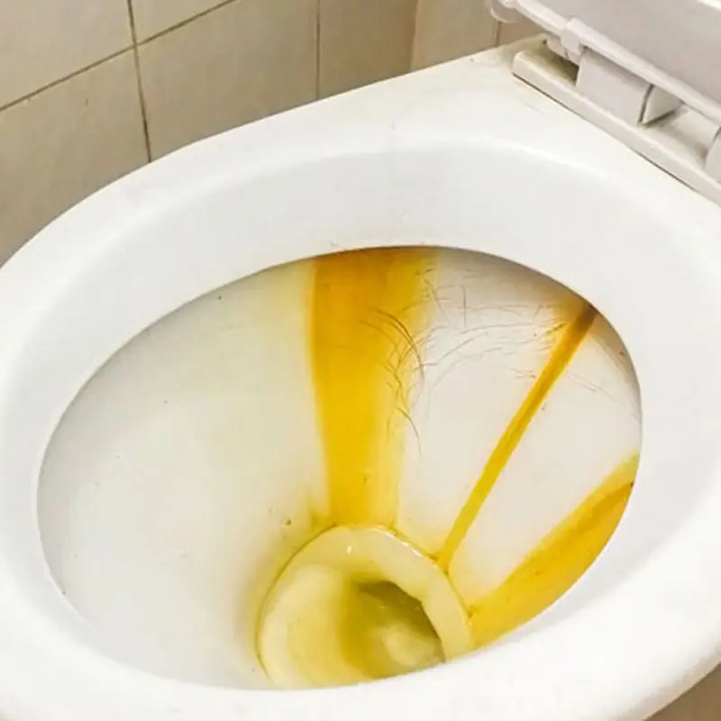 How to Restore a Yellowed Toilet Lid and Eliminate Odors Easily