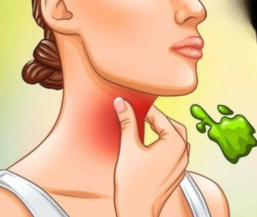 Causes of Mucus in the Throat and How to Deal With It