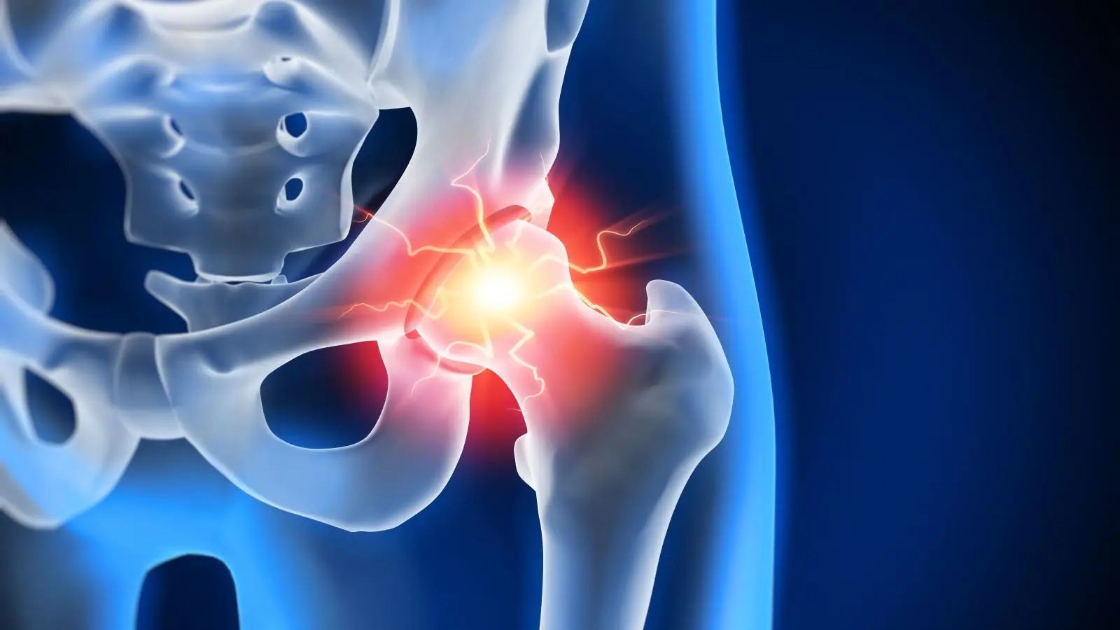 If Your Hip Hurts, Pay Attention: It May Be Trying to Warn You