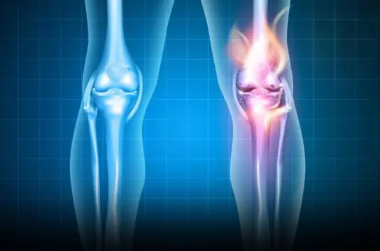 6 foods that silently drain calcium from the body, the more you eat, the weaker your bones become