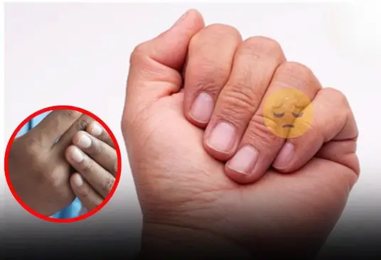 4 changes in fingers that could be signs of lung can.cer