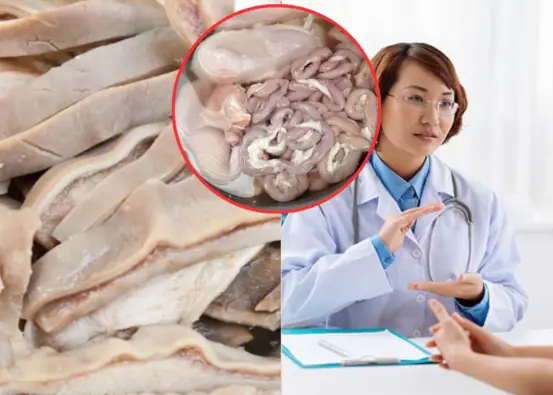 The 5 most valuable parts of a pig