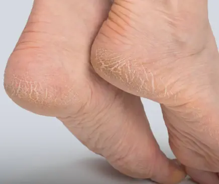 Pharmacist warns: Heel pa.in could signal a serious health issue!