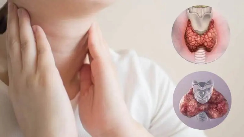 15 warning signs of low thyroid you can spot easily – don’t miss #7!