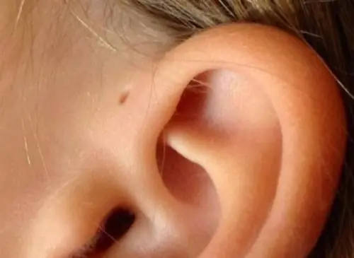 Have you seen this mark on someone’s ear? Here’s what it could mean