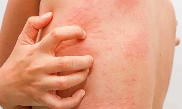 Itching All Over Your Body? Here’s What Your Body Might Be Trying to Tell You
