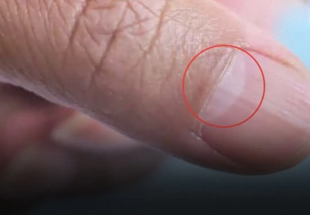 Check Your Nails: 3 Warning Signs You Should Never Ignore