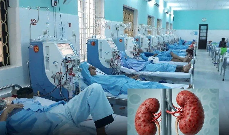 Kidney Atrophy Before 30? The Truth About “2 Dangerous Habits”