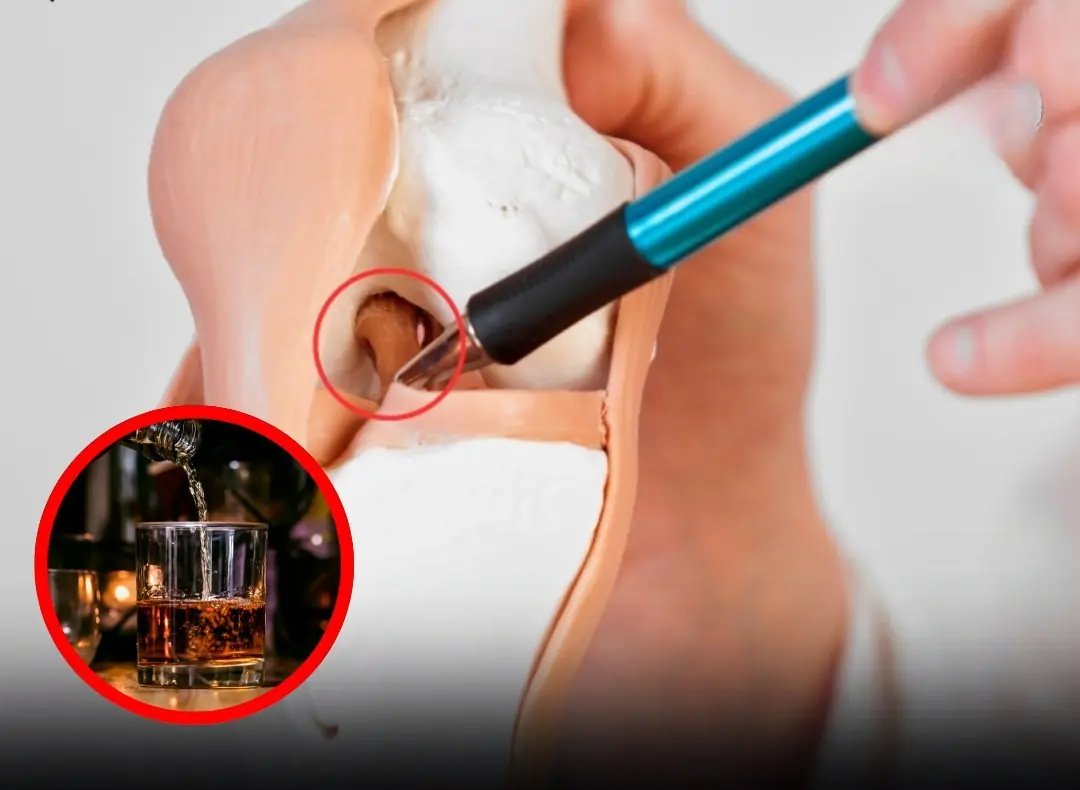 Think They’re Harmless? These 6 Foods Quietly Steal Calcium From Your Bones