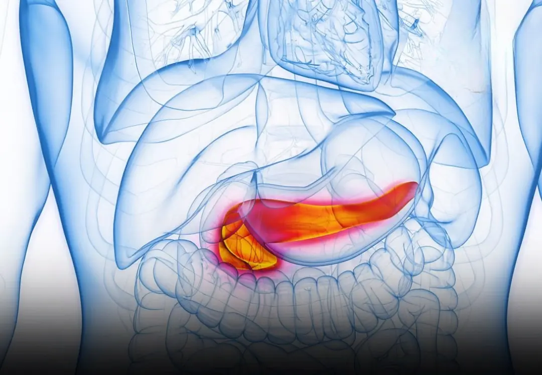 Pancreatic Cancer: Why Early Detection Matters & Signs You Shouldn’t Ignore