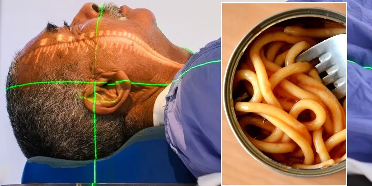 6 Everyday Foods Linked to Can.cer Risk That Many People Still Eat Daily
