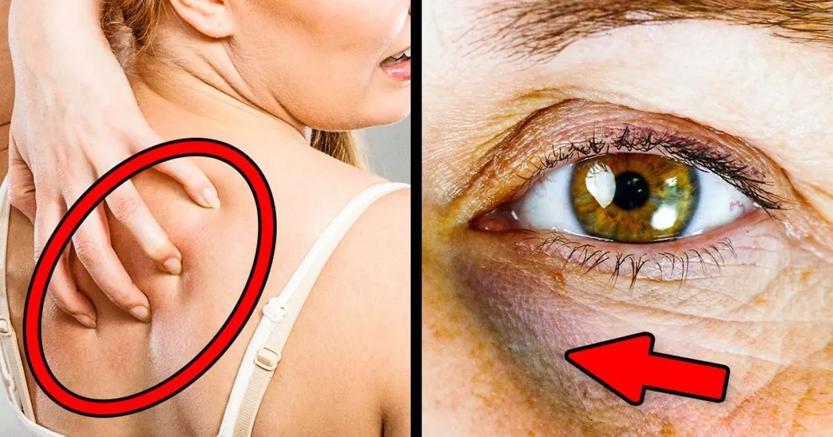 10 Signs You’re Eating Too Much Sugar — Warning Signals You Shouldn’t Ignore