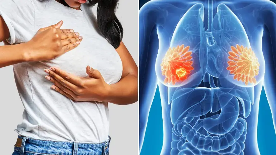 4 early signs of bre.ast can.cer you should never ignore