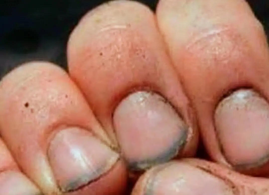 What do you call a person who has nails like that? The surprising truth behind this viral question