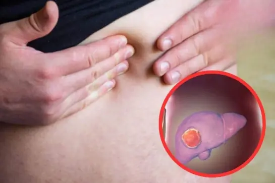 Big Belly Doesn’t Always Mean Fat: How to Distinguish Between Belly Fat and Liver Disease