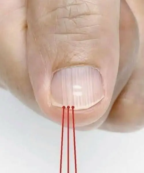 If you notice these lines on your nails after 40, what does it really mean?