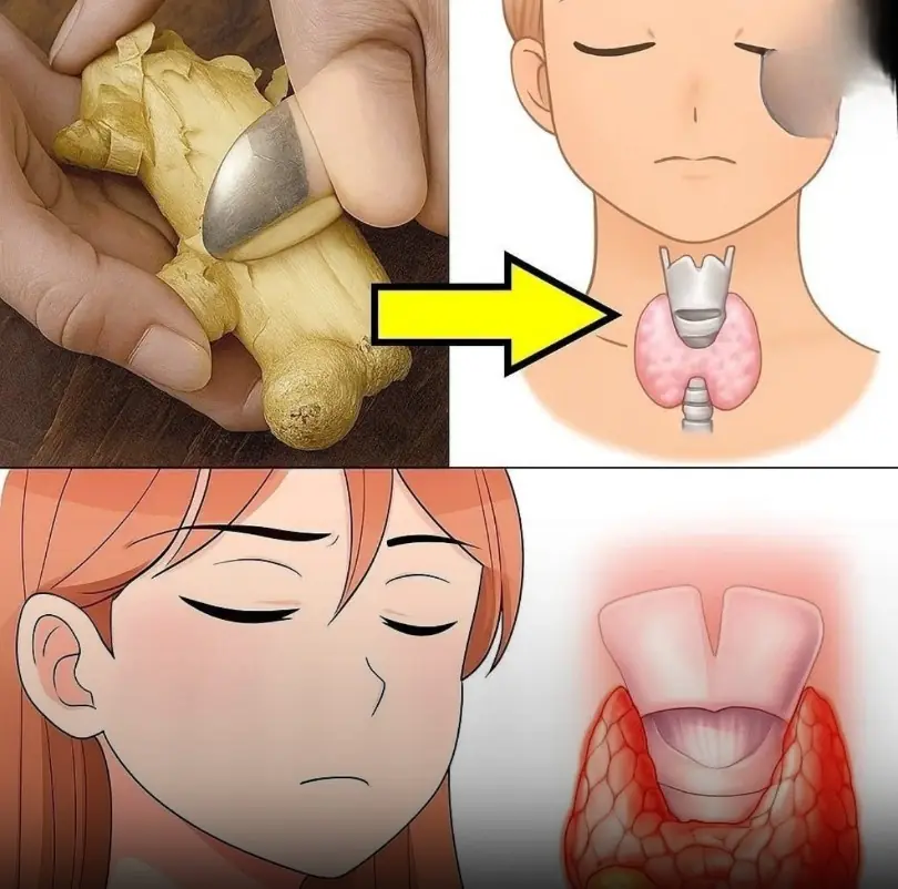 19 Foods to Avoid If You Have Hypothyroidism or Thyroid Problems