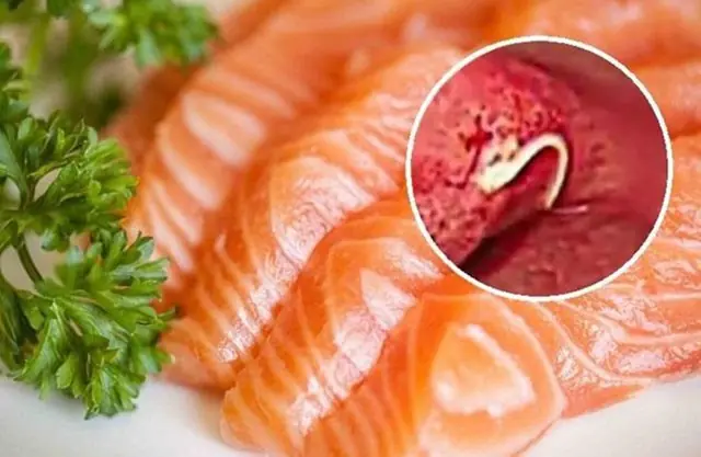 These foods may contain parasites - even in small amounts