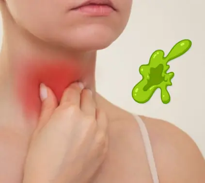 The Real Causes of Constant Phlegm and Mucus in Throat — And How to Get Rid of It