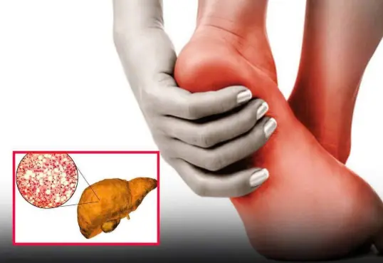If You Notice This Change in Your Feet, Your Fat:ty Liver May Be Beyond Repair