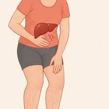 When Your Legs Are Crying for Help: 5 Important Things to Watch For