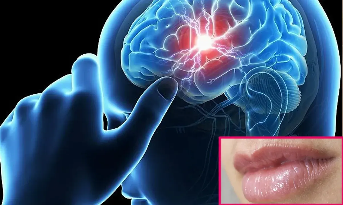 Doctor warns: The most dangerous sign of stroke is not blue lips — but these frequent abnormalities