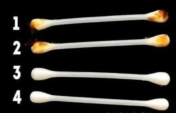 What Your Earwax Might Say About Your Health—And What This Viral Image Gets Wrong
