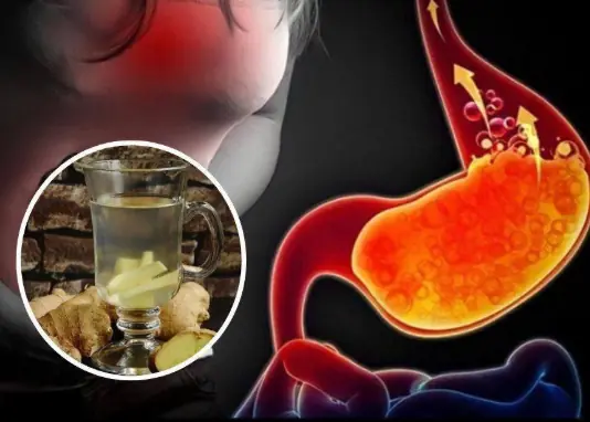 This drink helps reduce gastroesophageal reflux and heartburn effectively