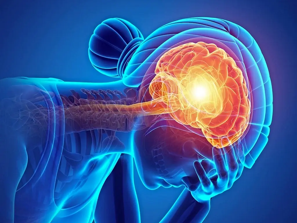 Early Warning Signs of a Brain Aneurysm: 12 Symptoms to Recognize