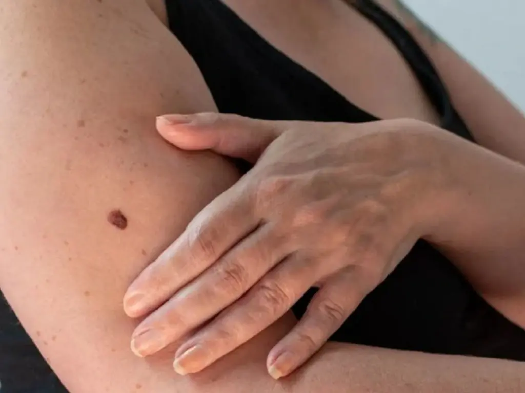 If you notice red.ness, it.ching, or ring-like marks, your skin could be signaling an issue