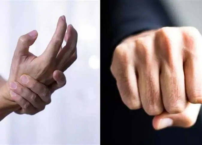 4 Changes in Hands and Feet That May Warrant Medical Attention